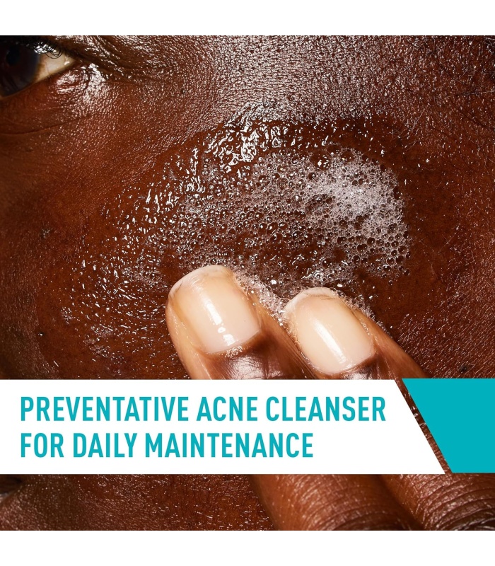 ژل شستشوي صورت ضد جوش و آکنه سراوی مدل بلميش236ميل