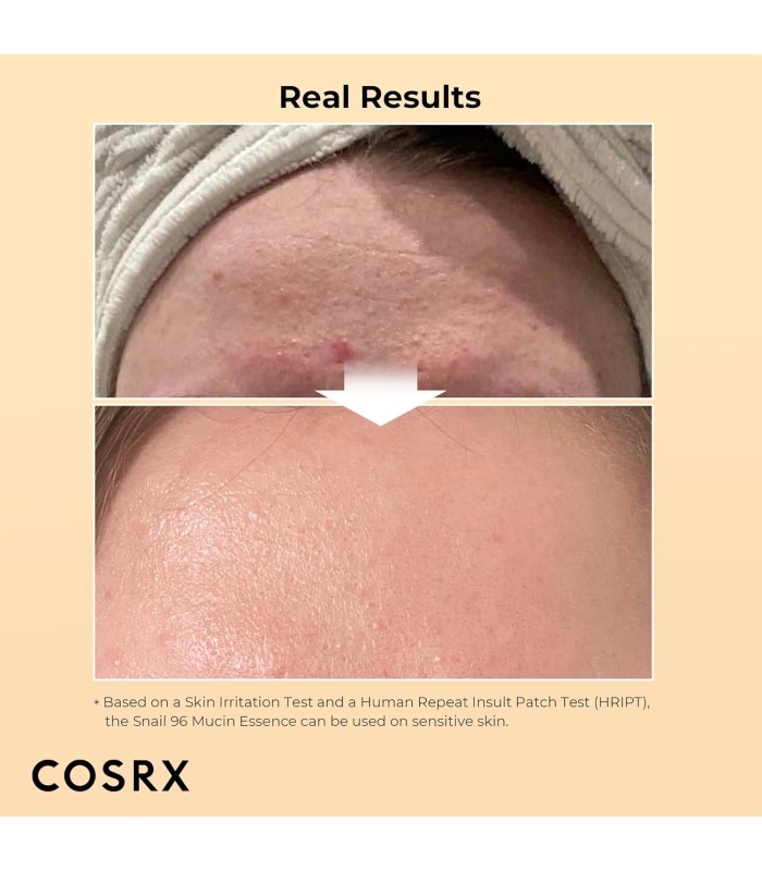 اسنس حلزون کوزارکس آبرسان وترمیم کننده