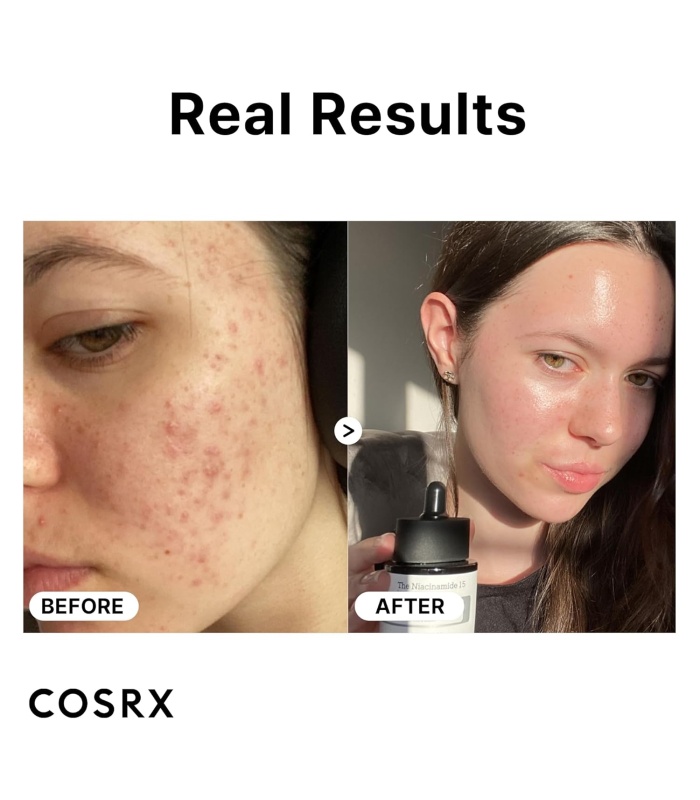 سرم نياسيناميد 15 کوزارکس ضد لک و روشن کننده 20 ميل