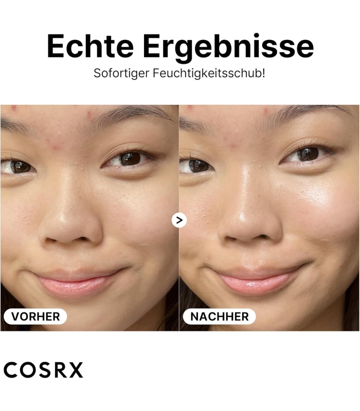 سرم هيالورونيک اسيد 3 درصد کوزارکس 20میل