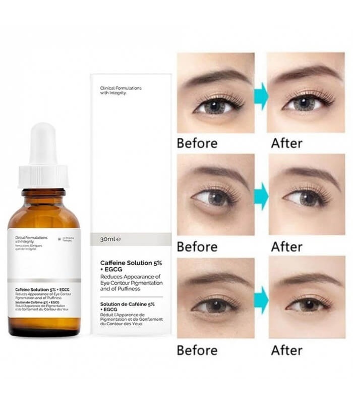 اوردینری سرم کافئین دور چشم   30 میلی لیتر