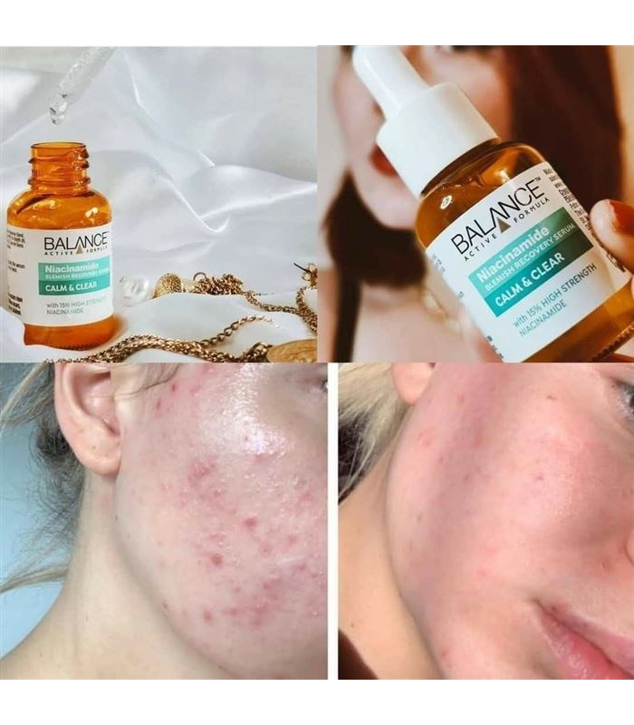 سرم ضد جوش و ضد لک نیاسین آمید بالانس 30 میلی لیتر