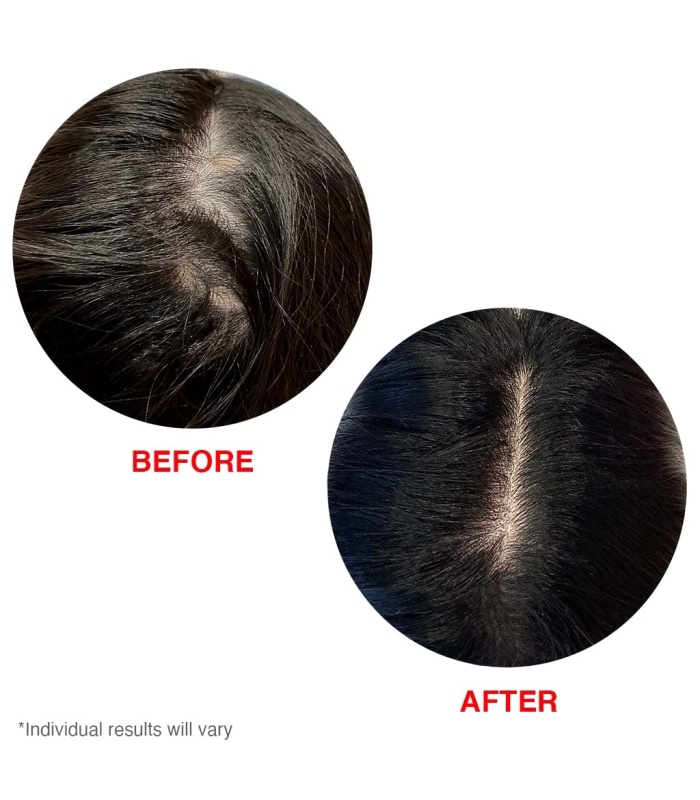 سرم مو هیرتامین تقویت کننده وضد ریزش مو ۶۰ میلی لیتر