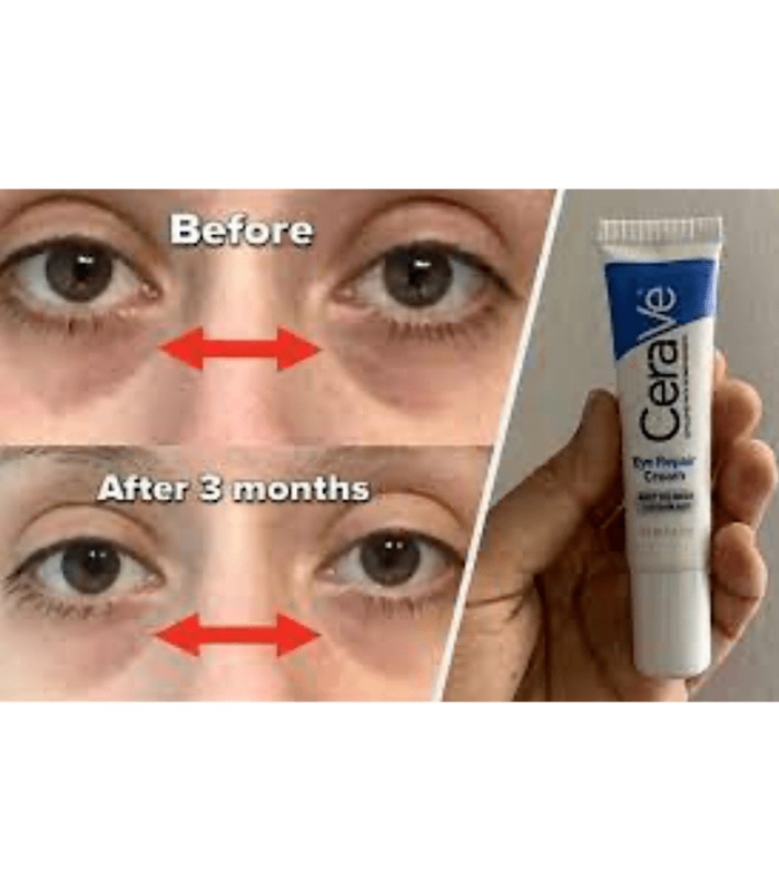 کرم دور چشم ترمیم کننده و روشن کننده سراوی (CeraVe Eye Repair Cream,14.2 g)